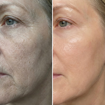 Mature Women’s Skin Recovery Stick