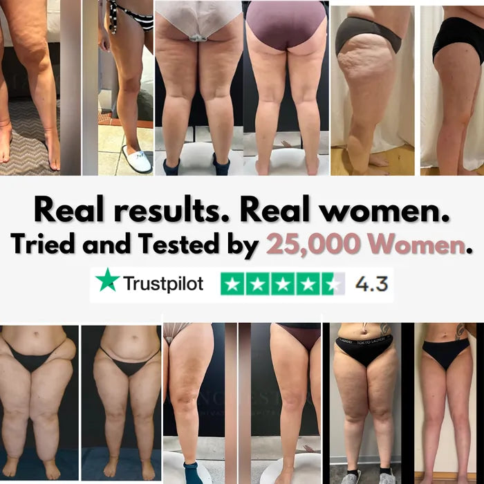 Elziq 3D Legging – Say goodbye to lipoedema pain and swelling naturally