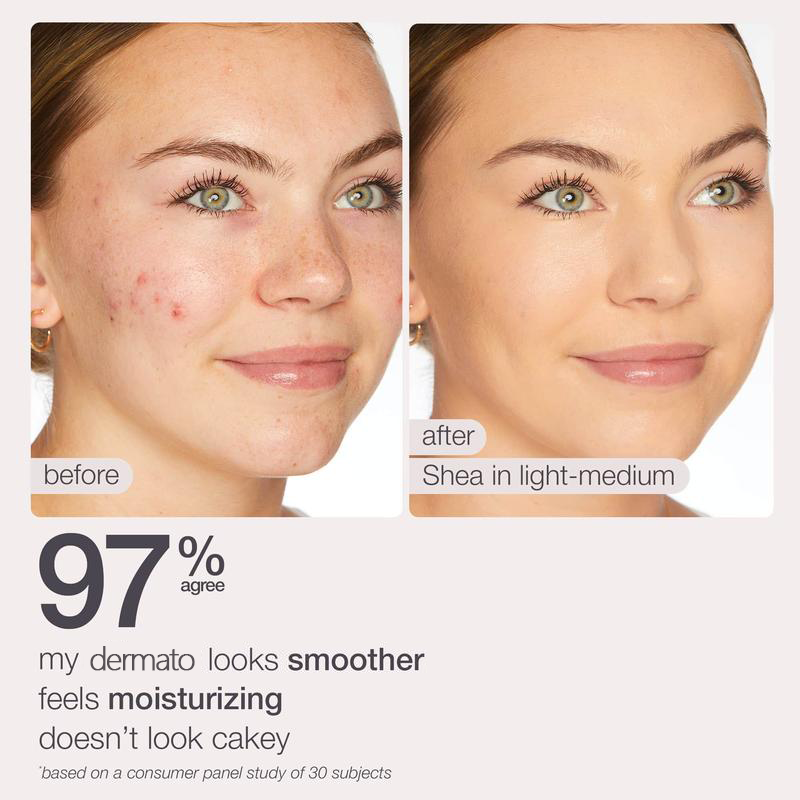 blur tinted moisturizer SPF 30 - instantly brightens, hydrates & smooths your dermato