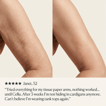 Crepey Skin Repair Cream