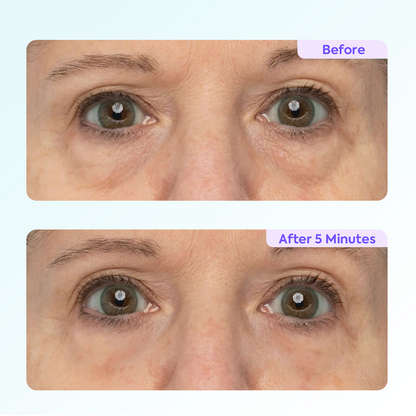 Instant Lift Eye Gel – Reduces the Look of Eye Bags