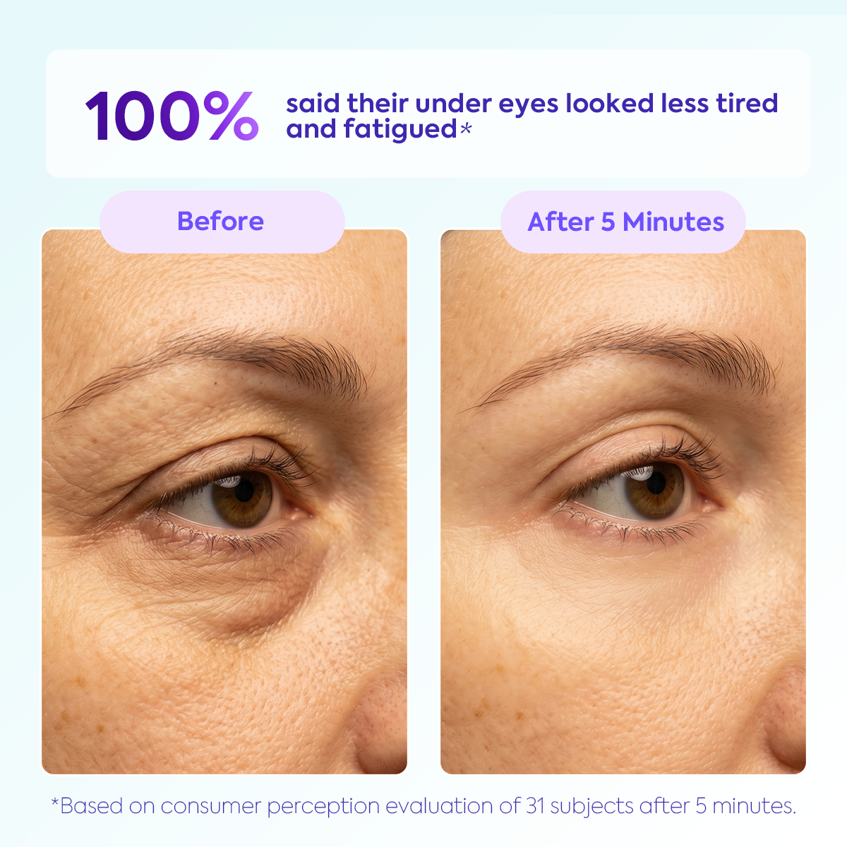 Instant Lift Eye Gel – Reduces the Look of Eye Bags
