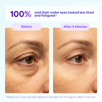 Instant Lift Eye Gel – Reduces the Look of Eye Bags